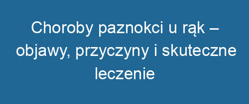 Choroby paznokci u rąk – objawy, przyczyny i skuteczne leczenie