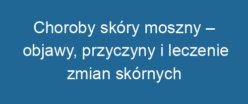 Choroby skóry moszny – objawy, przyczyny i leczenie zmian skórnych