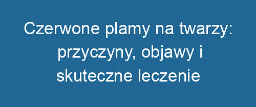 Czerwone plamy na twarzy: przyczyny, objawy i skuteczne leczenie