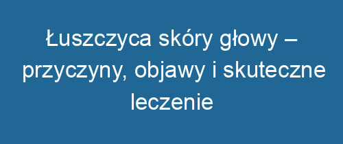 Łuszczyca skóry głowy – przyczyny, objawy i skuteczne leczenie