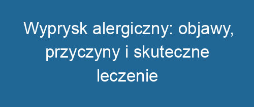 Wyprysk alergiczny: objawy, przyczyny i skuteczne leczenie